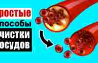 Естественные механизмы чистки сосудов – как включить их в полную силу - YouTube