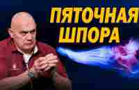 Пяточная шпора: причины, симптомы и последствия. Лучшие способы избавления от боли в пятках - YouTube