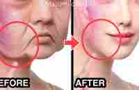 BEST ANTI-AGING FACE LIFTING EXERCISE AT HOME