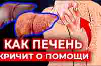 Скрытые признаки БОЛЬНОЙ ПЕЧЕНИ! | Спаси печень от ШЛАКОВ и ТОКСИНОВ! - YouTube