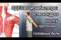 Сделал и на 10 лет забыл про остеохондроз. Не могу сутулиться, холка исчезла, зрение 1 - YouTube