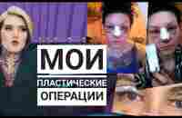 ВСЕ мои ПЛАСТИЧЕСКИЕ операции  ринопластика , блефаропластика , комки биша - YouTube