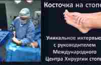 Косточки на стопе Вальгусная деформация Hallux valgus Уникальное интервью с КМН, хирургом-ортопедом. - YouTube