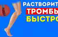 ЭТИ продукты БЫСТРО растворяют ТРОМБЫ в сосудах. Тромбоэмболия, варикоз, профилактика тромбоза - YouTube