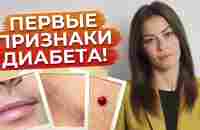 Как не допустить сахарный диабет? / Признаки сахарного диабета - YouTube