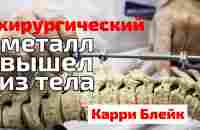 Хирургический металл вышел из тела | Карри Блейк - YouTube