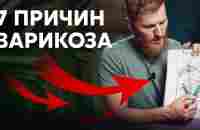 Избавься от ВАРИКОЗА навсегда, причины и способы решения - YouTube