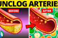 Top 10 Foods to Clean Your Arteries that Can Prevent a Heart Attack - YouTube