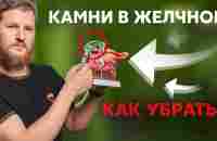 Камни в желчном пузыре - как убрать? - YouTube