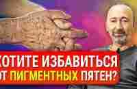 Как избавиться от пигментных ПЯТЕН на лице и теле? Причины появления. Старческие пигментные пятна. - YouTube