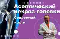 Асептический некроз головки бедренной кости - YouTube