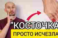 Сделал 1 раз и КОСТОЧКА на большом пальце стала меньше - YouTube