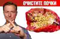 Очищение почек от оксалатов. Профилактика камней в почках ✅ - YouTube